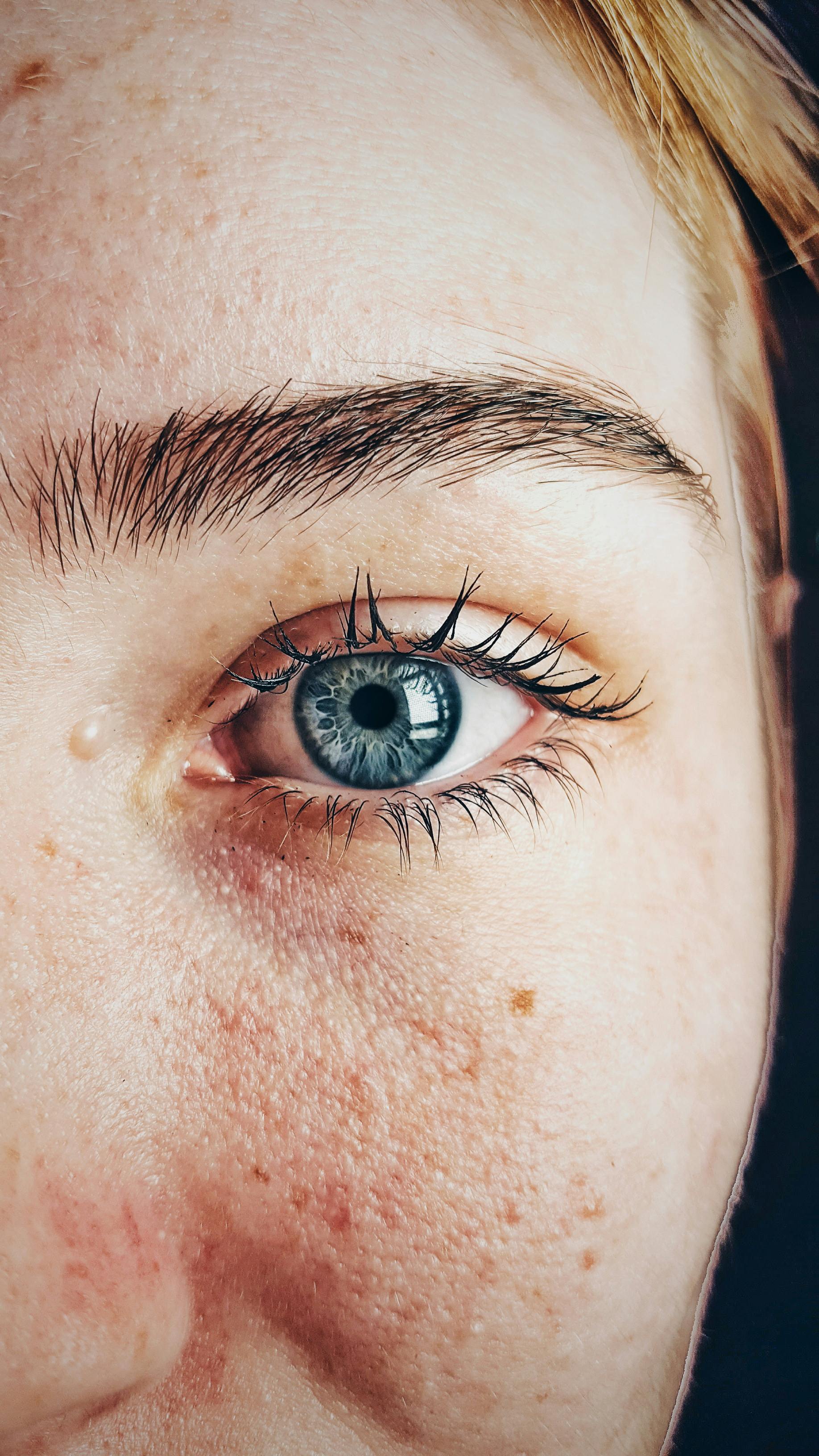 Skin-image